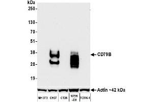 Western Blotting (WB) image for anti-CD79b Molecule, Immunoglobulin-Associated beta (CD79B) (AA 200-250) antibody (ABIN7454006)