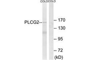 Western blot analysis of extracts from COLO205 cells, using PLCG2 (Ab-753) Antibody. (Phospholipase C gamma 2 抗体  (AA 721-770))