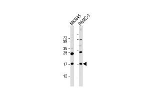 All lanes : Anti-FB Antibody (C-Term) at 1:2000 dilution Lane 1: MKN45 whole cell lysate Lane 2: NC-1 whole cell lysate Lysates/proteins at 20 μg per lane. (FAM159B 抗体  (AA 121-154))