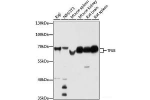 Western blot analysis of extracts of various cell lines using TFEB Polyclonal Antibody at dilution of 1:1000. (TFEB 抗体)