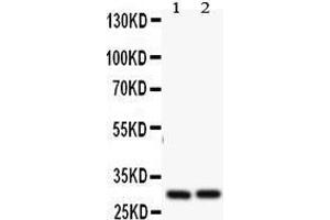 Anti- Bcl2A1 antibody, Western blotting All lanes: Anti Bcl2A1 at 0. (BCL2A1 抗体  (N-Term))