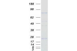 Validation with Western Blot (CPT1C Protein (Transcript Variant 2) (Myc-DYKDDDDK Tag))