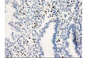 Image no. 1 for anti-Signal Transducer and Activator of Transcription 4 (STAT4) antibody (ABIN1501180) (STAT4 抗体)