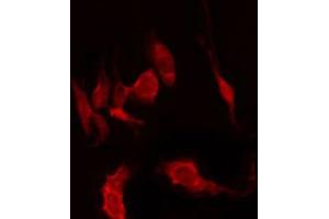 Immunofluorescence (fixed cells) (IF/ICC) image for anti-Cytochrome P450, Family 2, Subfamily W, Polypeptide 1 (CYP2W1) (Internal Region) antibody (ABIN6258069)