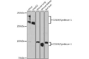 Western blot analysis of extracts of various cell lines, using Syndecan 1 Rabbit mAb (ABIN1683195, ABIN3018651, ABIN3018652 and ABIN7101639) at 1:1000 dilution. (Syndecan 1 抗体)