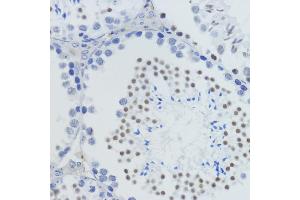 Immunohistochemistry of paraffin-embedded mouse testis using MonoMethyl-Histone H4-K20 antibody (ABIN3016044, ABIN3016045, ABIN3016046, ABIN1680258 and ABIN6219531) at dilution of 1:200 (40x lens). (Histone H4 抗体  (meLys20))