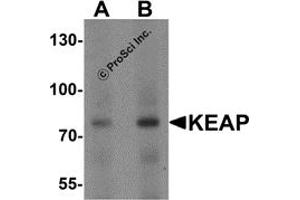 Western Blotting (WB) image for anti-Kelch-Like ECH-Associated Protein 1 (KEAP1) (C-Term) antibody (ABIN1077378) (KEAP1 抗体  (C-Term))