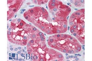 Immunohistochemistry (IHC) image for anti-Ferritin, Light Polypeptide (FTL) (C-Term) antibody (ABIN334402)