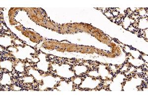 Immunohistochemistry (IHC) image for anti-Charcot-Leyden Crystal Protein (CLC) (AA 2-142) antibody (ABIN7434860)