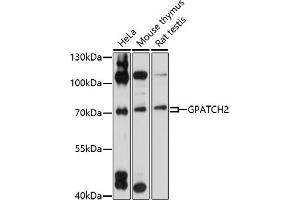 Western blot analysis of extracts of various cell lines, using GP antibody (ABIN7267287) at 1:1000 dilution. (GPATCH2 抗体  (AA 1-250))