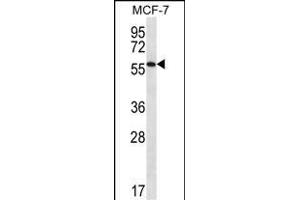 SL1 Antibody (C-term) (ABIN656721 and ABIN2845948) western blot analysis in MCF-7 cell line lysates (35 μg/lane). (SAAL1 抗体  (C-Term))