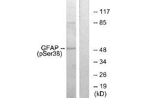 Western blot analysis of extracts from HeLa cells, using GFAP (Phospho-Ser38) antibody. (GFAP 抗体  (pSer38))