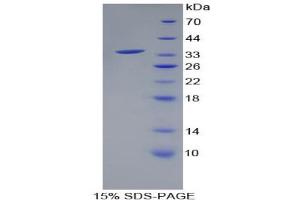 SDS-PAGE analysis of Human HSD17B1 Protein. (HSD17B1 蛋白)