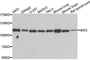 Western blot analysis of extracts of various cells, using BOC antibody. (BOC 抗体)