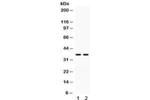 Western blot testing of human 1) HeLa and 2) K562 cell lysate with CD58 antibody. (CD58 抗体)