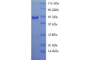 SDS-PAGE (SDS) image for Interferon gamma (IFNG) (AA 21-164) protein (GST tag) (ABIN5712988)