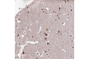 Immunohistochemical staining of human cerebral cortex with THOC7 polyclonal antibody  shows moderate nuclear positivity in neuronal cells at 1:200-1:500 dilution.