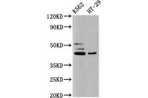 Western Blot Positive WB detected in: K562 whole cell lysate, HT29 whole cell lysate All lanes: B3GNT6 antibody at 10 μg/mL Secondary Goat polyclonal to rabbit IgG at 1/50000 dilution Predicted band size: 43, 30 kDa Observed band size: 43 kDa (B3GNT6 抗体  (AA 251-345))