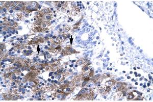 Human Liver (NFYA 抗体  (C-Term))