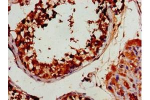 Immunohistochemistry of paraffin-embedded human testis tissue using ABIN7165627 at dilution of 1:100 (HEXIM2 抗体  (AA 1-286))