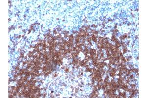 Immunohistochemistry (IHC) image for anti-B-cell antigen receptor complex-associated protein alpha chain (CD79A) (AA 202-216) antibody (ABIN6941270)
