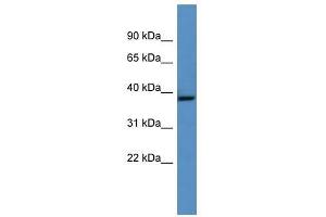 Ghitm antibody used at 0. (GHITM 抗体  (Middle Region))