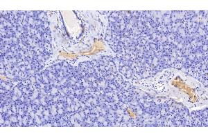 Detection of HB in Human Pancreas Tissue using Polyclonal Antibody to Hemoglobin (HB) (Hemoglobin 抗体)
