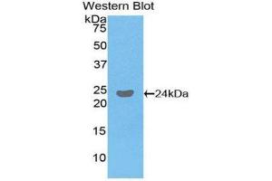 Western Blotting (WB) image for anti-Fc Fragment of IgG, Low Affinity IIIb, Receptor (CD16b) (FCGR3B) (AA 24-203) antibody (ABIN1858834)