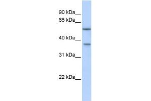 WB Suggested Anti-RAB40B Antibody Titration: 0. (RAB40B 抗体  (Middle Region))