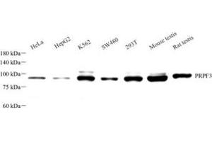 Western blot analysis of PRPF3 (ABIN7075311) at dilution of 1: 500