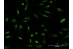 Immunofluorescence of monoclonal antibody to DUSP1 on HeLa cell. (DUSP1 抗体  (AA 305-367))