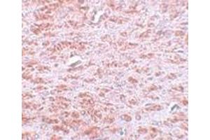 Immunohistochemistry (IHC) image for anti-Caudal Type Homeobox 2 (CDX2) (C-Term) antibody (ABIN1030331) (CDX2 抗体  (C-Term))