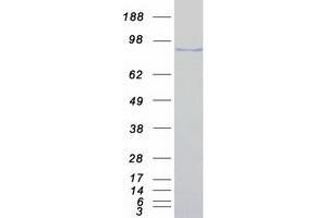 Western Blotting (WB) image for Mediator Complex Subunit 15 (MED15) (Transcript Variant 2) protein (Myc-DYKDDDDK Tag) (ABIN2725734)