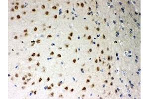 IHC-P: PKC iota antibody testing of mouse brain tissue (PKC iota 抗体  (AA 21-214))