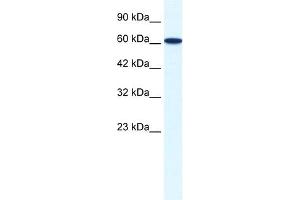 WB Suggested Anti-ZNF266 Antibody Titration:  0. (ZNF266 抗体  (N-Term))