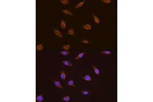 Immunofluorescence analysis of L929 cells using TSG101 antibody  at dilution of 1:100. (TSG101 抗体  (C-Term))