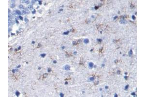 Immunohistochemistry (IHC) image for anti-Glial Fibrillary Acidic Protein (GFAP) (AA 1-430) antibody (ABIN7427078)