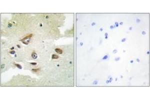 Immunohistochemistry analysis of paraffin-embedded human brain, using CLUS Antibody. (Clusterin 抗体  (AA 400-449))