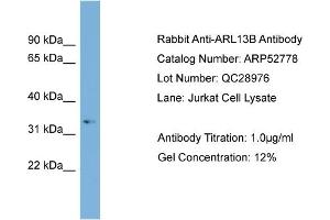 WB Suggested Anti-ARL13B  Antibody Titration: 0. (ARL13B 抗体  (Middle Region))