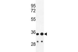 Western blot analysis of IGH antibody and HL-60, A2058 lysate. (IgH 抗体  (AA 290-320))