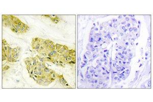 Immunohistochemistry (IHC) image for anti-Collagen, Type V, alpha 3 (COL5A3) (N-Term) antibody (ABIN1850292) (COL5A3 抗体  (N-Term))