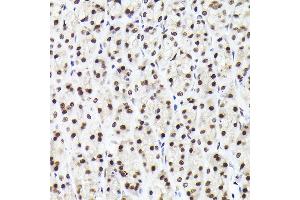 Immunohistochemistry (IHC) image for anti-RAD21 Homolog (RAD21) antibody (ABIN7269822)