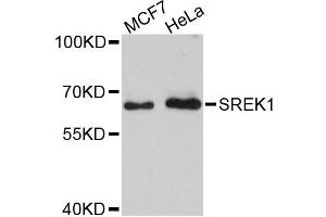 Western blot analysis of extracts of various cell lines, using SREK1 antibody. (SFRS12 抗体)