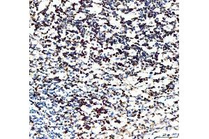 IHC analysis of CD5 using anti-CD5 antibody (ABIN5693203). (CD5 抗体  (AA 25-495))