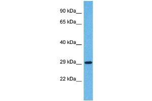 Western Blotting (WB) image for anti-Olfactory Receptor, Family 5, Subfamily H, Member 14 (OR5H14) (C-Term) antibody (ABIN2791756) (OR5H14 抗体  (C-Term))