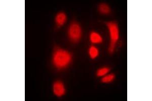 Immunofluorescent analysis of SGK1/2 (pT256/253) staining in HeLa cells. (SGK1/2 (pSer253), (pSer256) 抗体)
