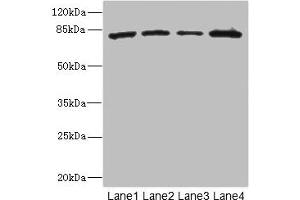 Western blot All lanes: ZP2 antibody at 3. (ZP2 抗体  (AA 651-745))