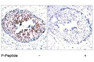 Image no. 1 for anti-Signal Transducer and Activator of Transcription 5A (STAT5A) (pSer780) antibody (ABIN196698) (STAT5A 抗体  (pSer780))