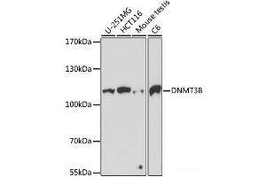Western blot analysis of extracts of various cell lines using DNMT3B Polyclonal Antibody at dilution of 1:1000. (DNMT3B 抗体)