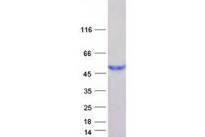 Western Blotting (WB) image for HEN1 Methyltransferase Homolog 1 (HENMT1) (Transcript Variant 2) protein (Myc-DYKDDDDK Tag) (ABIN2722619)